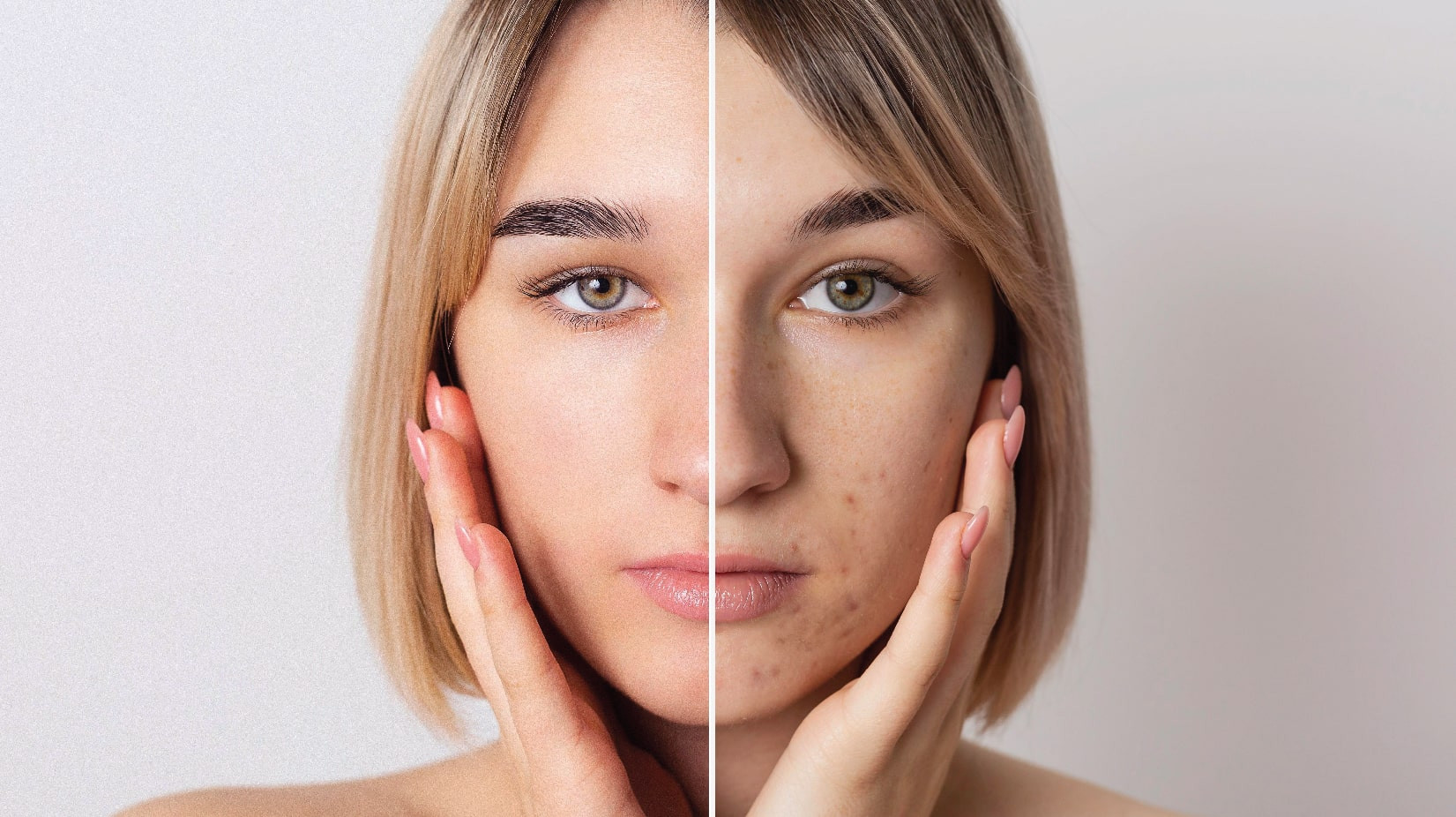 Skin Care